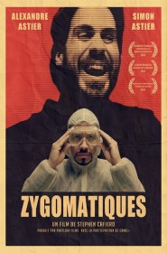 Zygomatiques